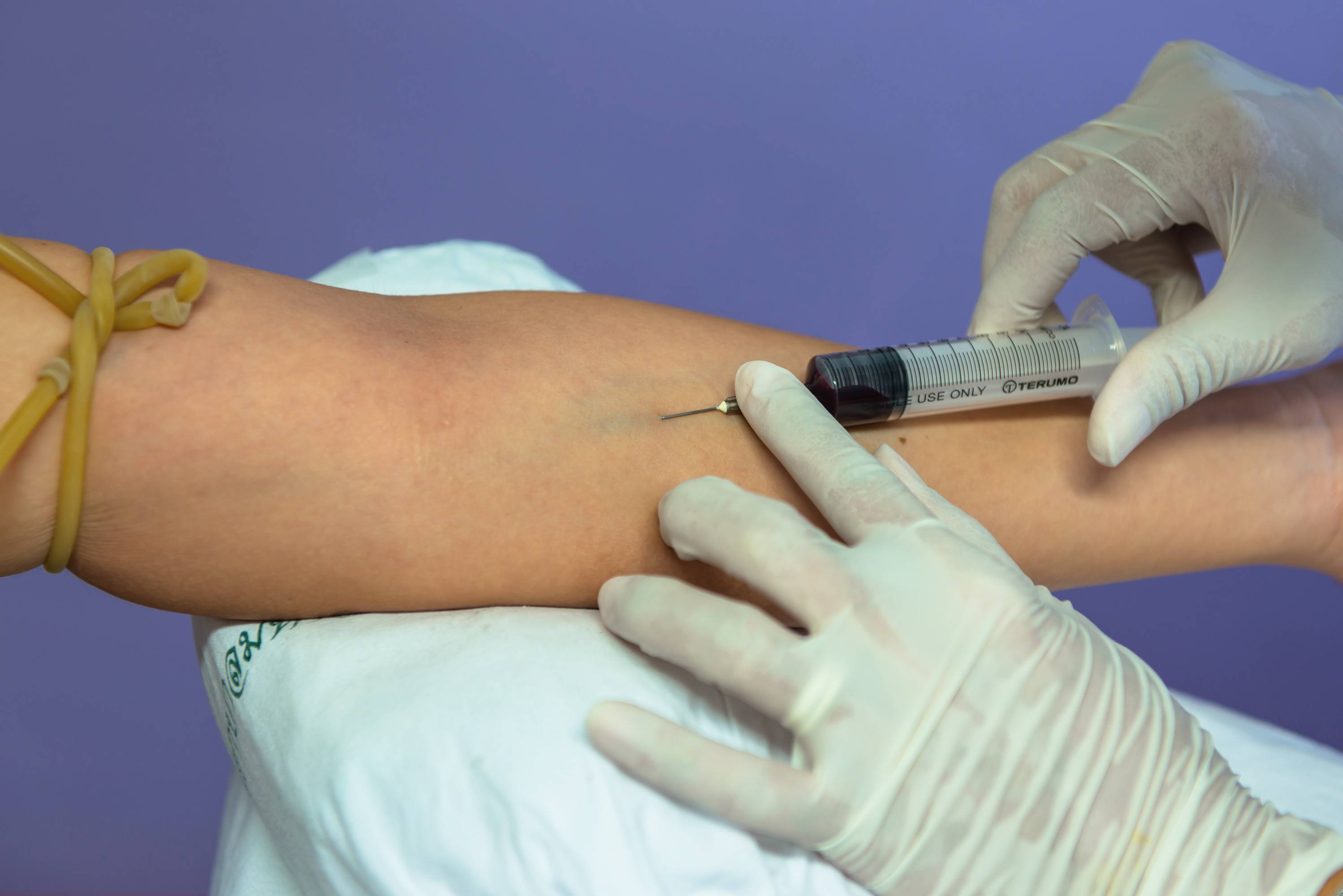 Muestra de sangre para análisis clínicos