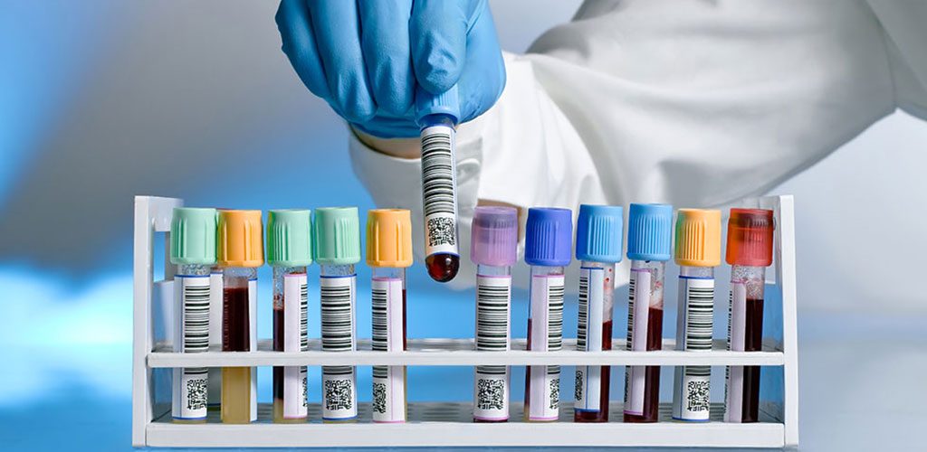 Muestras preparadas para análisis clínicos